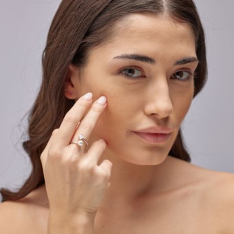 Anello